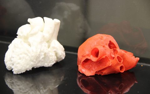 3D-операции на сердце. Белорусские специалисты делятся опытом с врачами из Германии.